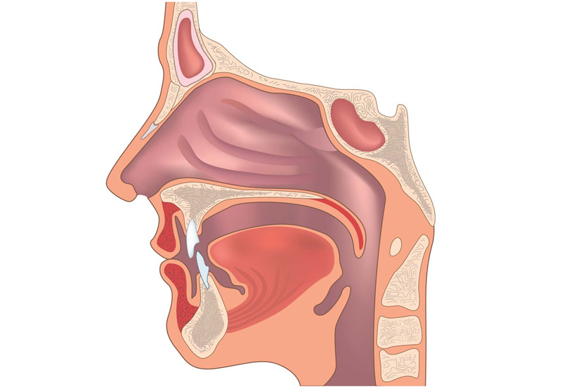anatomy-of-superior-canal-dehiscence